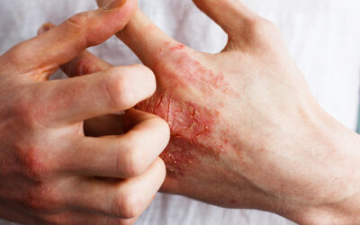 Urgent Care Guide for Skin Conditions