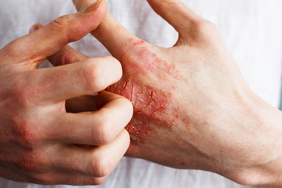 Urgent Care Guide for Skin Conditions